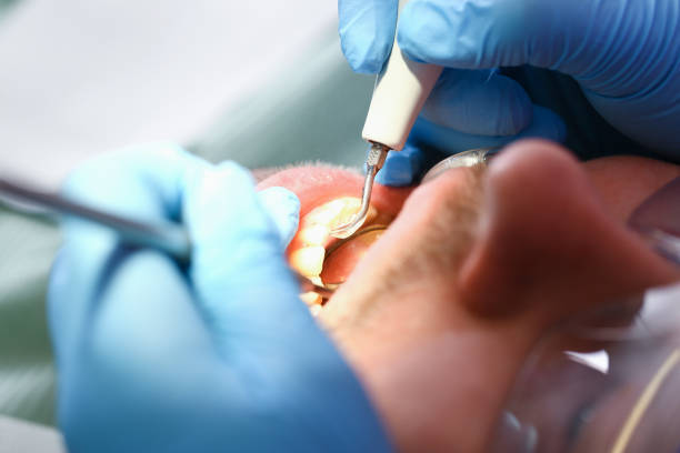 Best Emergency Treatment for Oral Infections in Beverly, MA