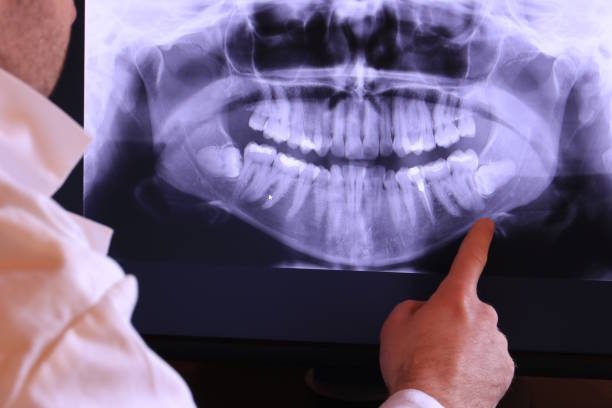 Best Emergency Cosmetic Dentistry (e.g., broken veneers) in Beverly, MA