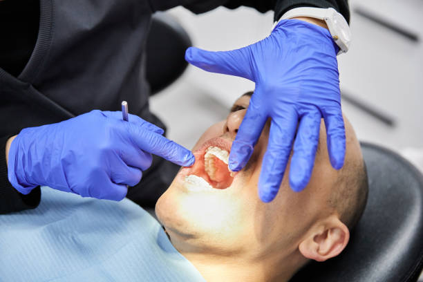 Best Emergency Denture Repair in Beverly, MA